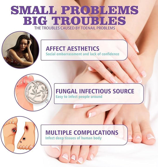 Nail healing & care Spray / رذاذ العناية بالأظافر وعلاجها